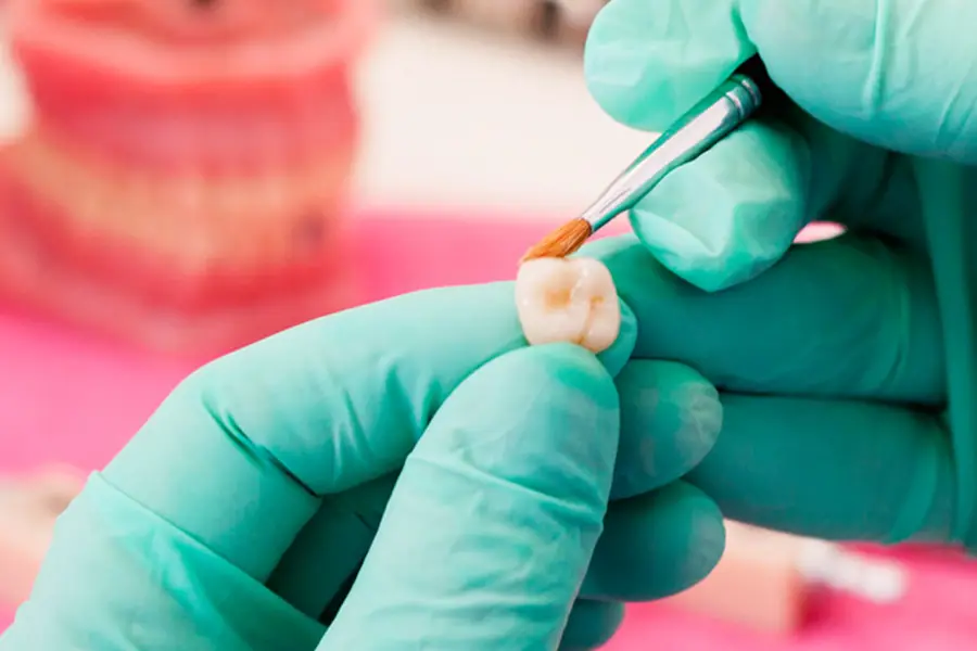 A fake tooth being custom made as part of the bespoke dental services offered at Bicester Dental.