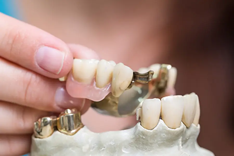 An image of a dentist in Bicester Dental setting dentures in a plastic mouth.